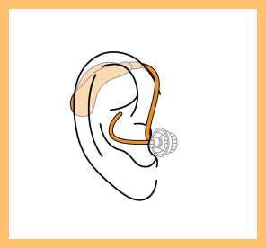 Receiver-in-Canal Hearing aid illustration